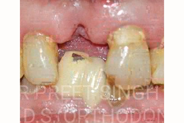 Dr Preet Dental