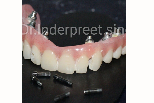Dr Preet Dental
