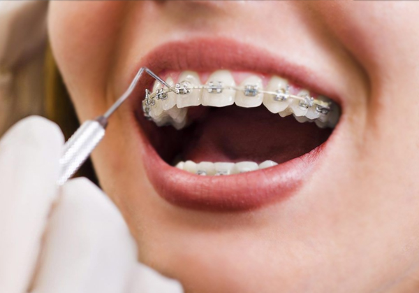 Advance Orthodontic